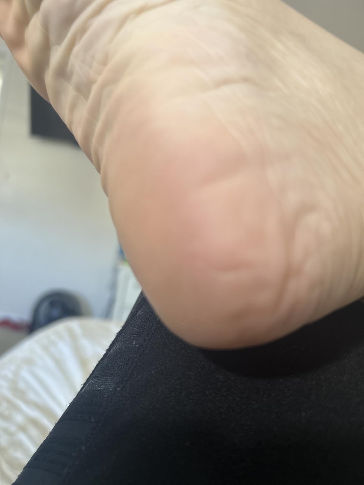 Aquaphor Healing Ointment, Advanced Therapy Skin Protectant, Multi-Purpose Healing Ointment and Body Moisturizer, For Dry, Cracked Skin, Minor Cuts and Burns, 14 Oz Jar customer photo 2