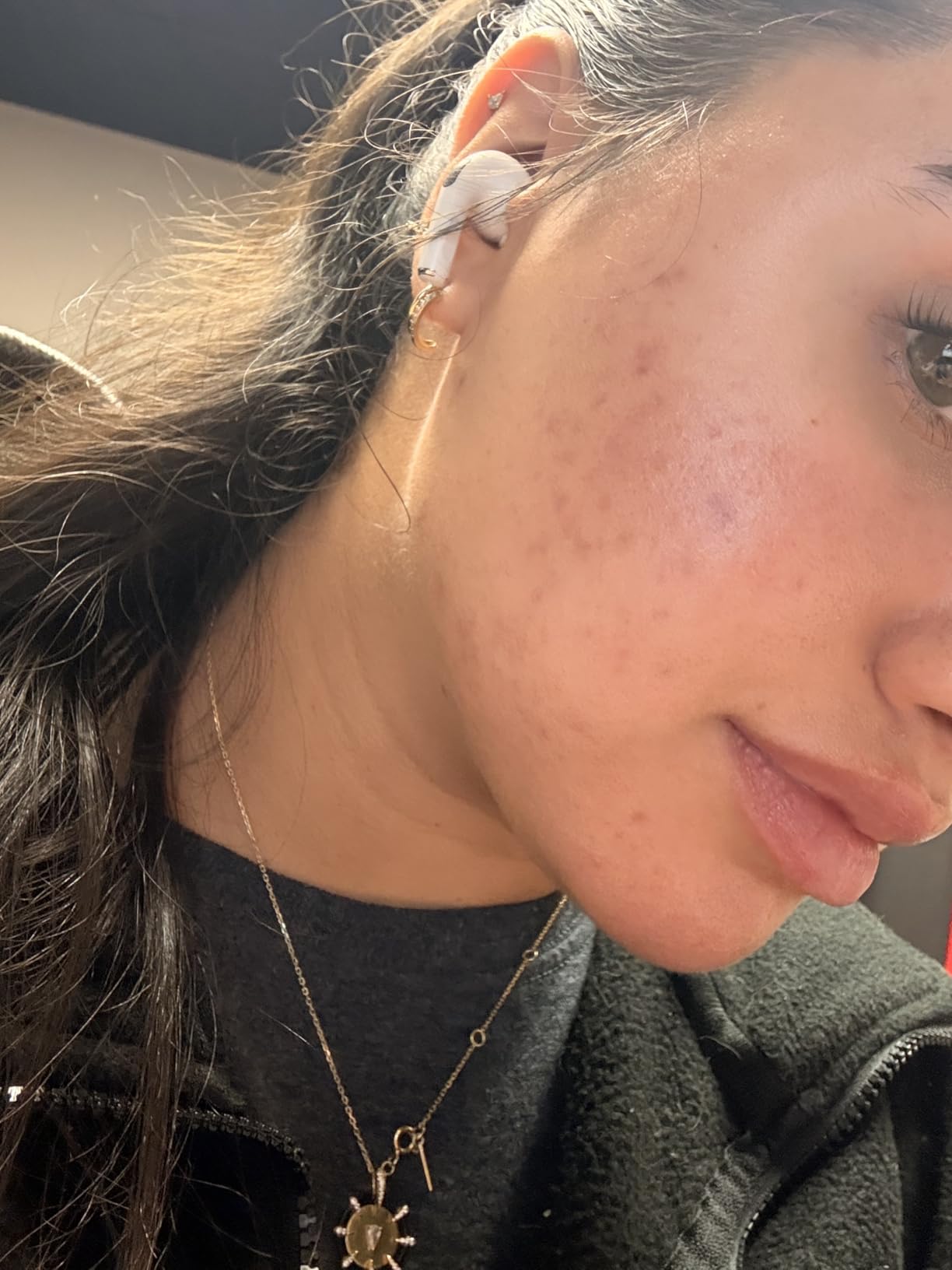 TruSkin Vitamin C Serum for Face - Anti Aging Face Serum with Hyaluronic Acid & Vitamin E - Brightening Formula for Improving Appearance of Dark Spots, Fine Lines & Wrinkles - All Skin Types, 2 Fl Oz customer photo 1