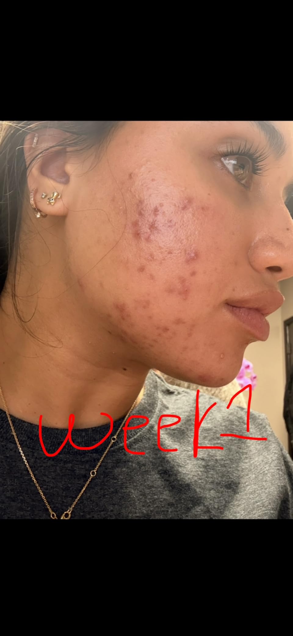 TruSkin Vitamin C Serum for Face - Anti Aging Face Serum with Hyaluronic Acid & Vitamin E - Brightening Formula for Improving Appearance of Dark Spots, Fine Lines & Wrinkles - All Skin Types, 2 Fl Oz customer photo 2