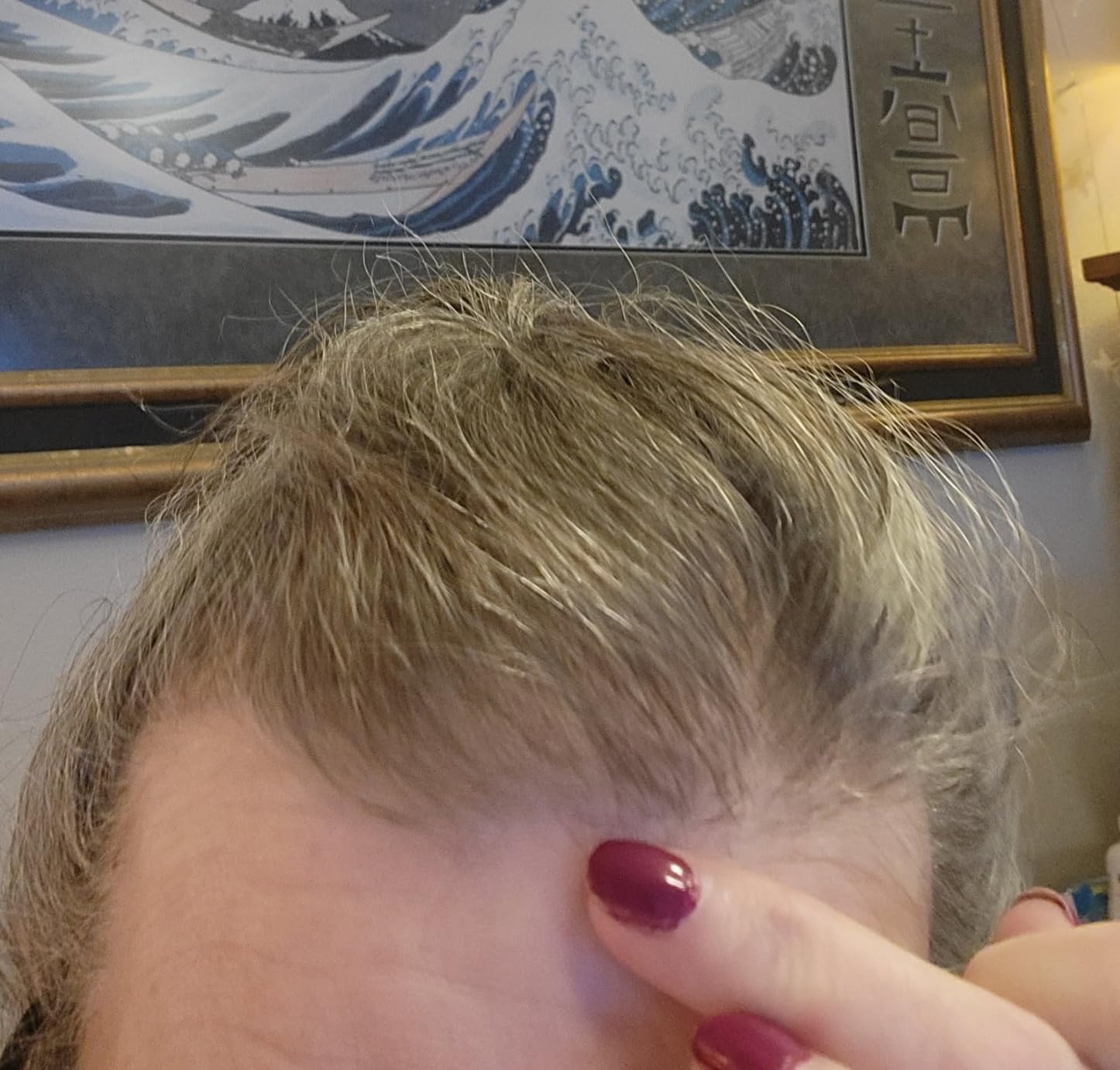 Nature's Bounty Biotin 10000mcg Supplement, Supports Healthy Hair, Skin and Nails, Optimal Solutions Hair Vitamin with Biotin, 90 Rapid Release Liquid Softgels customer photo 1