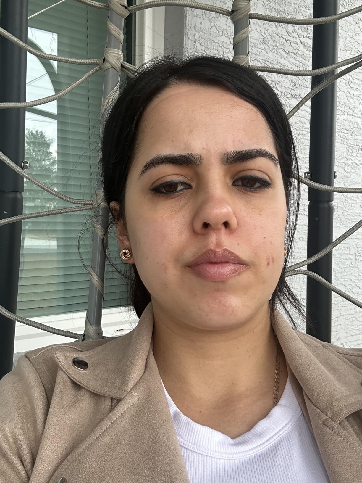 La Roche-Posay Pure 12% Vitamin C Serum For Face With Hyaluronic Acid & Salicylic Acid, Hydrating Face Serum, Boost Radiance & Reduce Wrinkles, 2 Formulas for Normal or Oily Skin Control customer photo 1