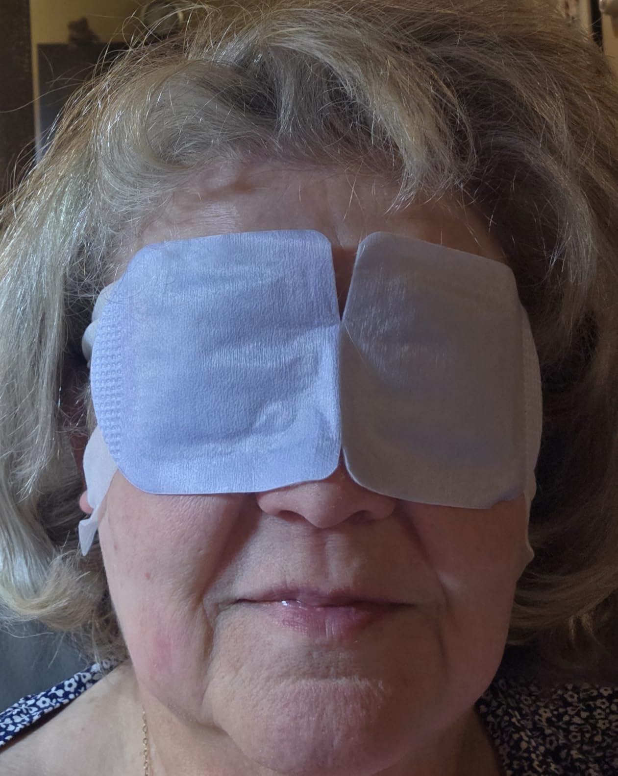 CorneaCare Rest: Self Heating Warm Compress for Dry Eyes | Heated Eye Mask for Fast Relief | Steam Mask for Stye Care | No Microwave or Washcloth Needed | Travel Ready Warm Compress | 30 Count customer photo 1