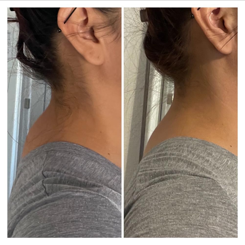 Neck Stretcher for Pain Relief, Neck and Shoulder Relaxer Cervical Traction Device Pillow for Muscle Relax and TMJ Pain Relief (Blue) customer photo 1