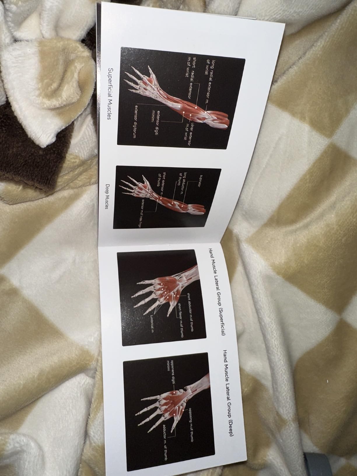 FitBeast Grip Strength Trainer, Finger Exerciser, Forearm Strengthener 9-Piece Kit, Hand Grip Strengthener Targeted Strength, Relief & Recovery customer photo 2