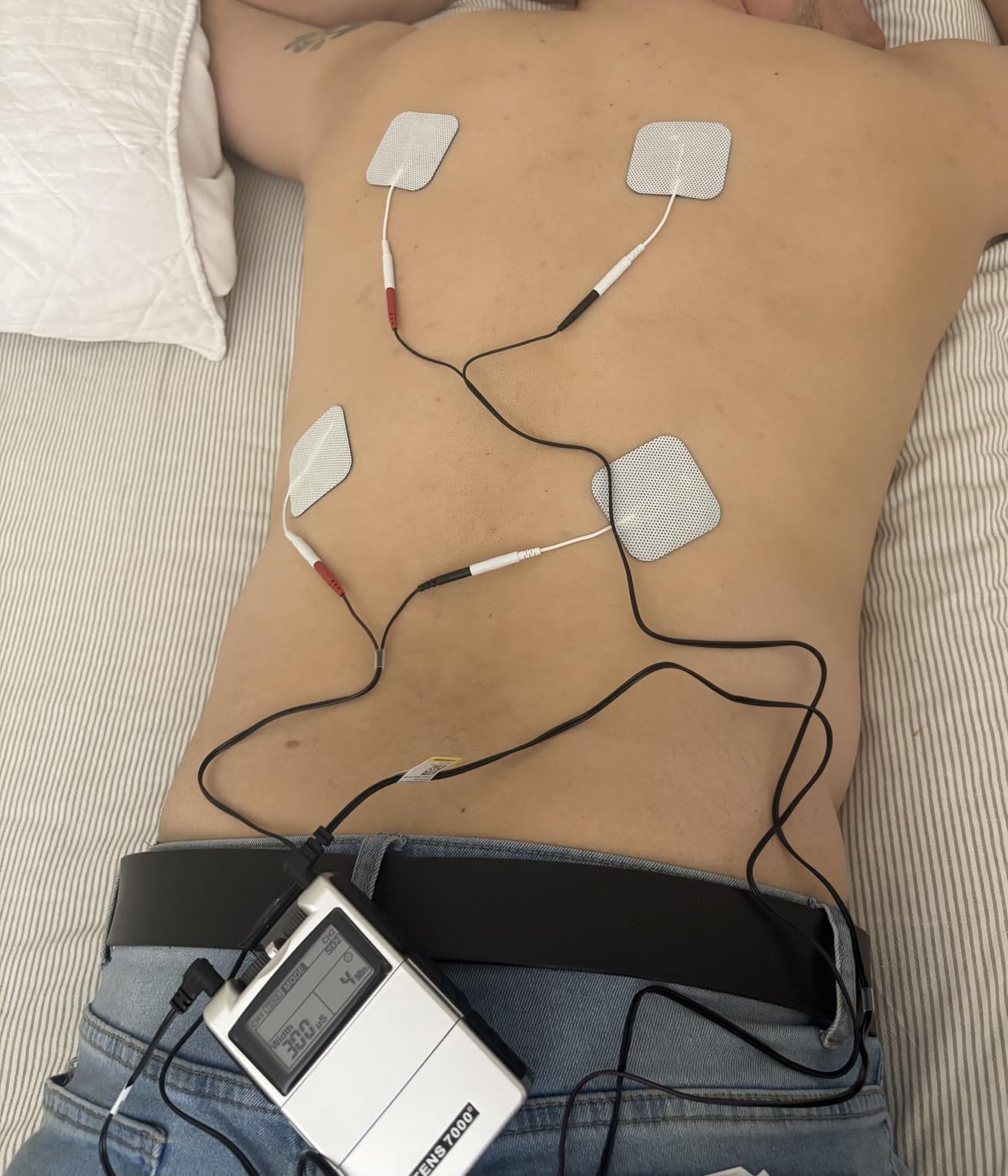Digital TENS Unit with Accessories - Muscle Stimulator Machine for Back Pain Relief, Sciatica, Neck, Nerve, Shoulder, Hip, Elbow, Muscle Pain Relief customer photo 2