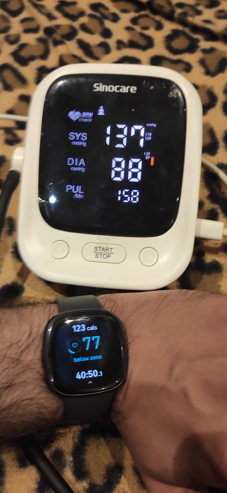 Sense 2 Health and Fitness Smartwatch - Shadow Grey/Graphite | with Stress and Sleep Tools - 3-Month Google Health Premium Membership Included - ECG App, SpO2, 24/7 Heart Rate, and GPS customer photo 2