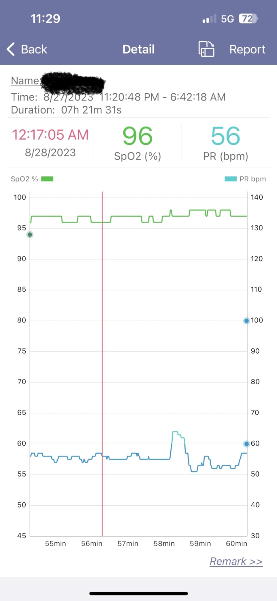 EMAY SleepO2 Wrist Pulse Oximeter with Recording Capability | Sleep Pulse Oximeter for Continuous O2 Recording | Not for Medical Use customer photo 1