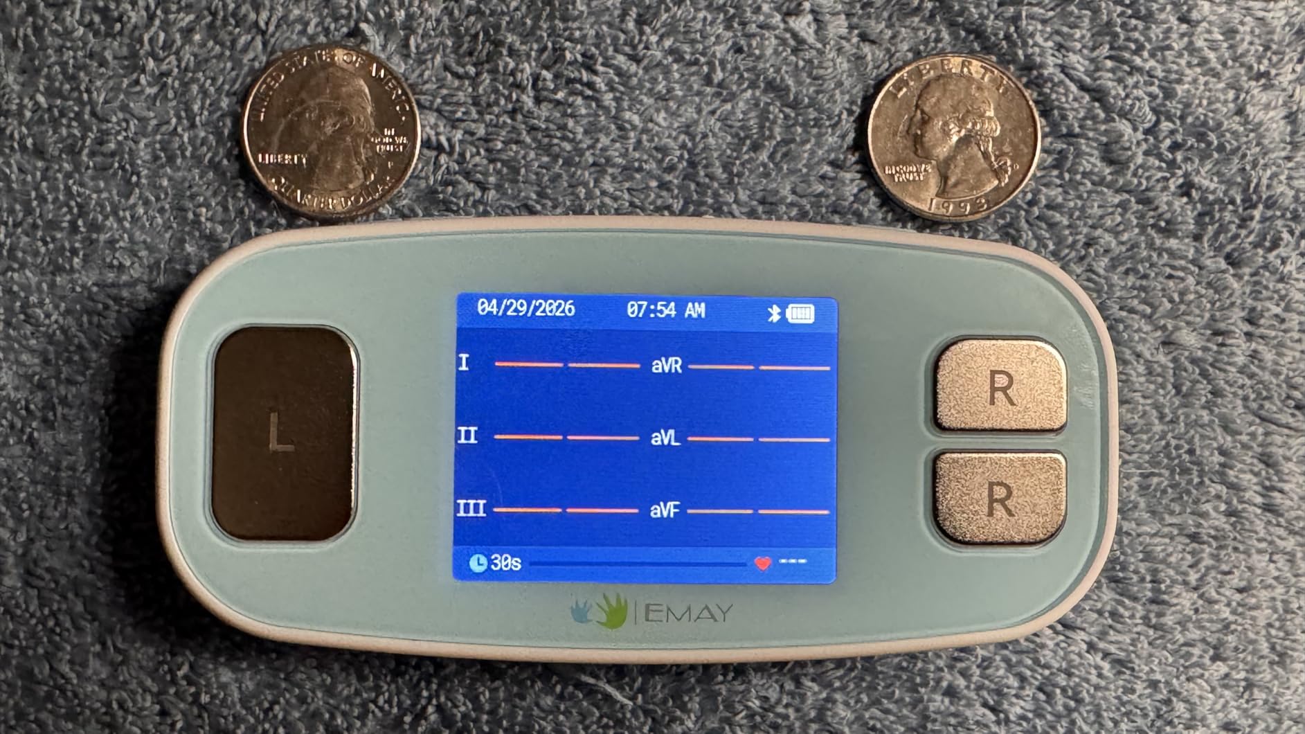EMAY 6L Portable ECG Monitor | Record ECG and Heart Rate in 6 Channels | Compatible with Smartphone and PC | No Subscription Required customer photo 2